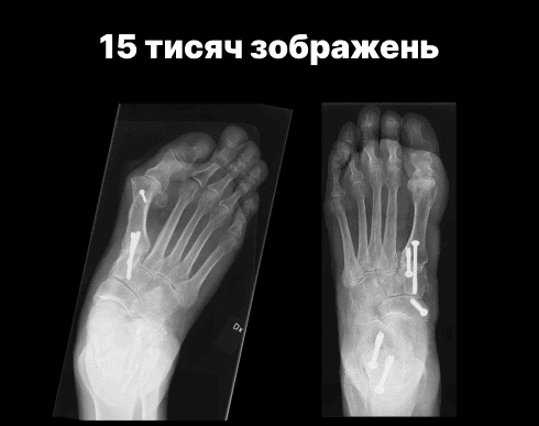 Пам’ять
15 000 зображень.

