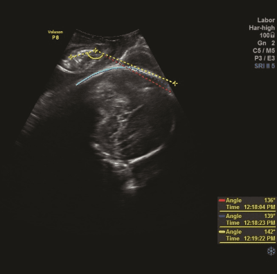 SonoVCADlabor 
