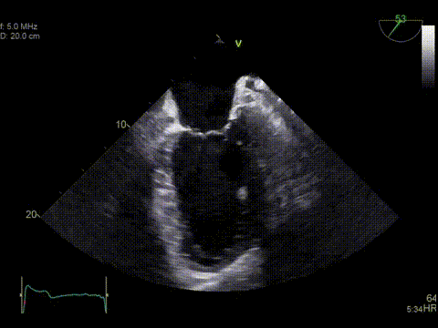 True Confocal Imaging
Забезпечує відмінну просторову та часову контрастність у зображенні 2D.
