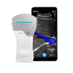 УЗД VSCAN AIR CL