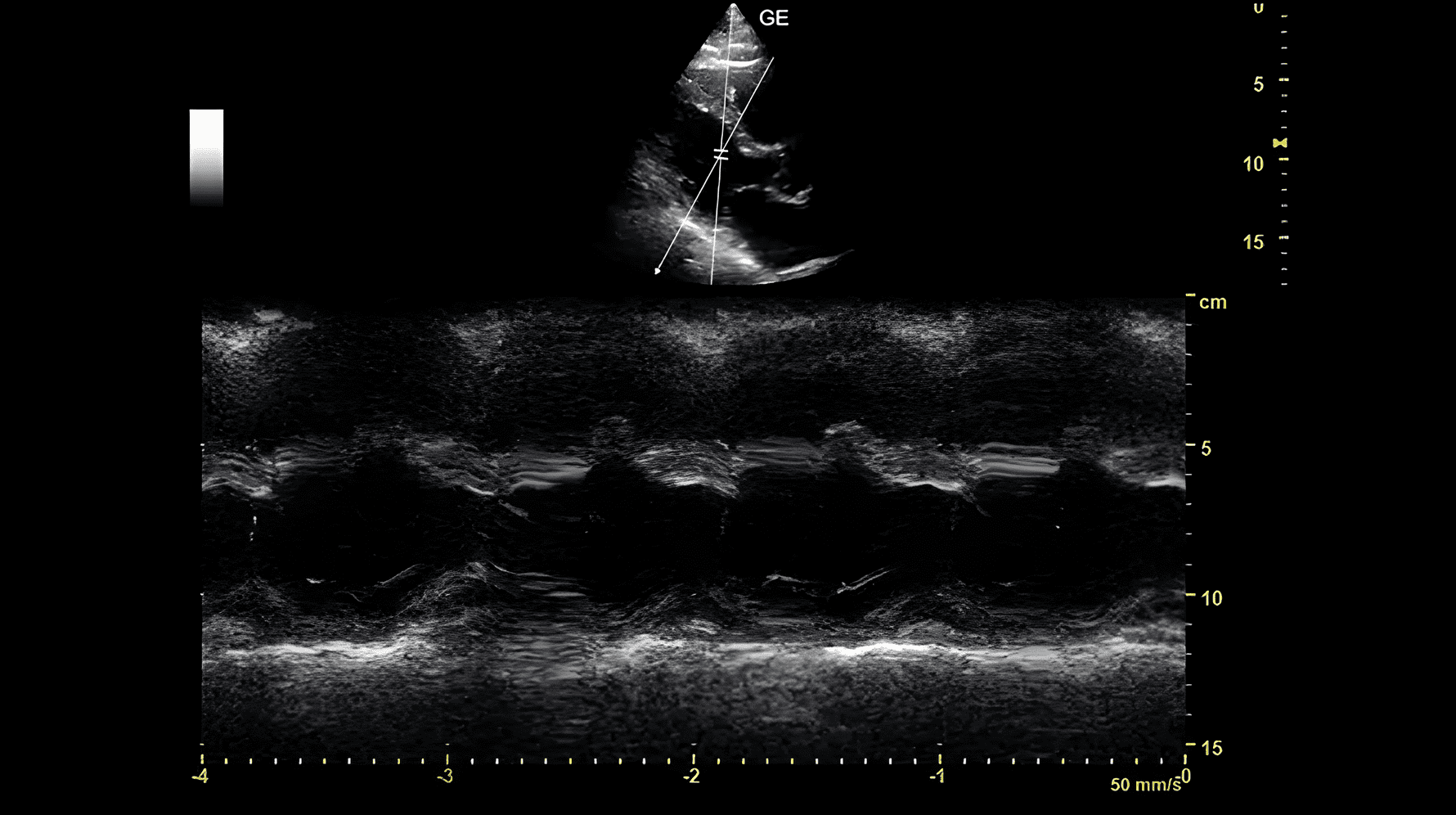 Анатомічний М-режим