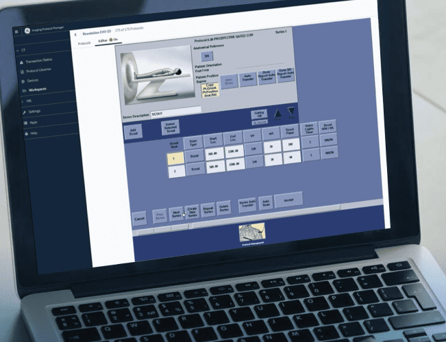 Програмний пакет Imaging Protocol Manager 
Віддалено завантажуйте, редагуйте та контролюйте протоколи для кількох методів дослідження, включаючи КТ і МРТ.
