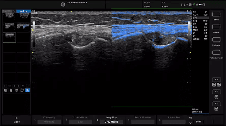 Follow Up Fusion – порівняння живого скану з архівним зображенням