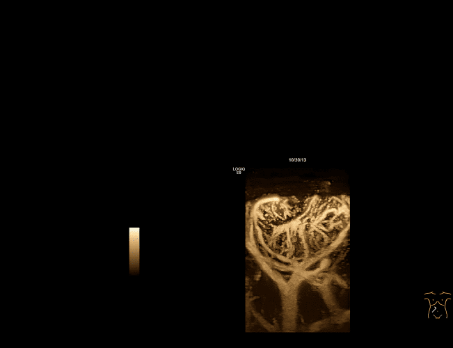Contrast Enhanced Ultrasound (УЗД з контрастним посиленням) 