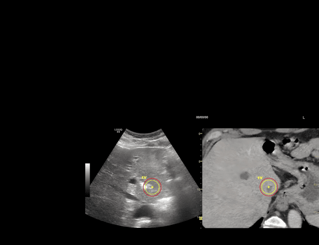 Fusion Imaging
