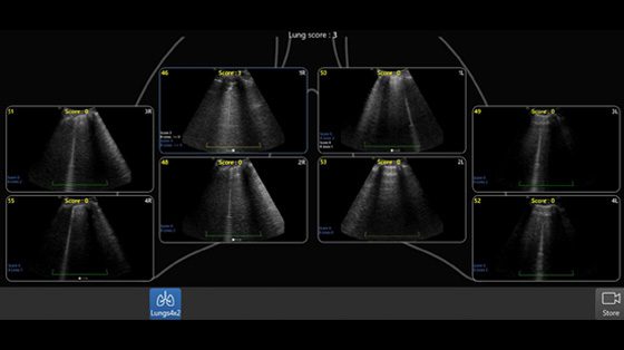 Lung Diagram