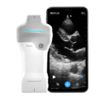 УЗД VSCAN AIR SL