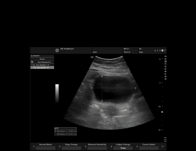 Функція Auto Bladder