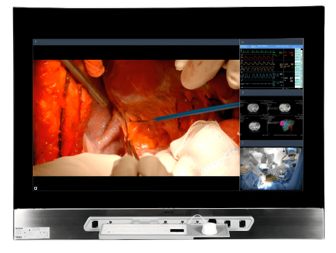 Хірургічний дисплей MDMX-25500 GNNB
Технічні характеристики:

■ Активний розмір екрану(ВхШ):1210x680mm
■ Технологія екрану: IPS/WLED
■ Розмір діагоналі: 1388mm (54.64”)
■ Співвідношення сторін: 16:9
■ Власна роздільна здатність: 3840×2160
■ Яскравість: 500cd/m²
■ Коефіцієнт контрастності: 1100:1

