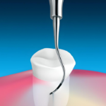 Зонди для фуркацій 01(33)