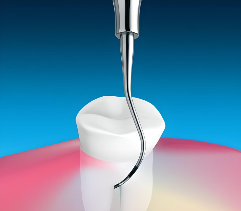 Зонди для фуркацій 01(33)