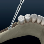 Стамески Freer 29(80)