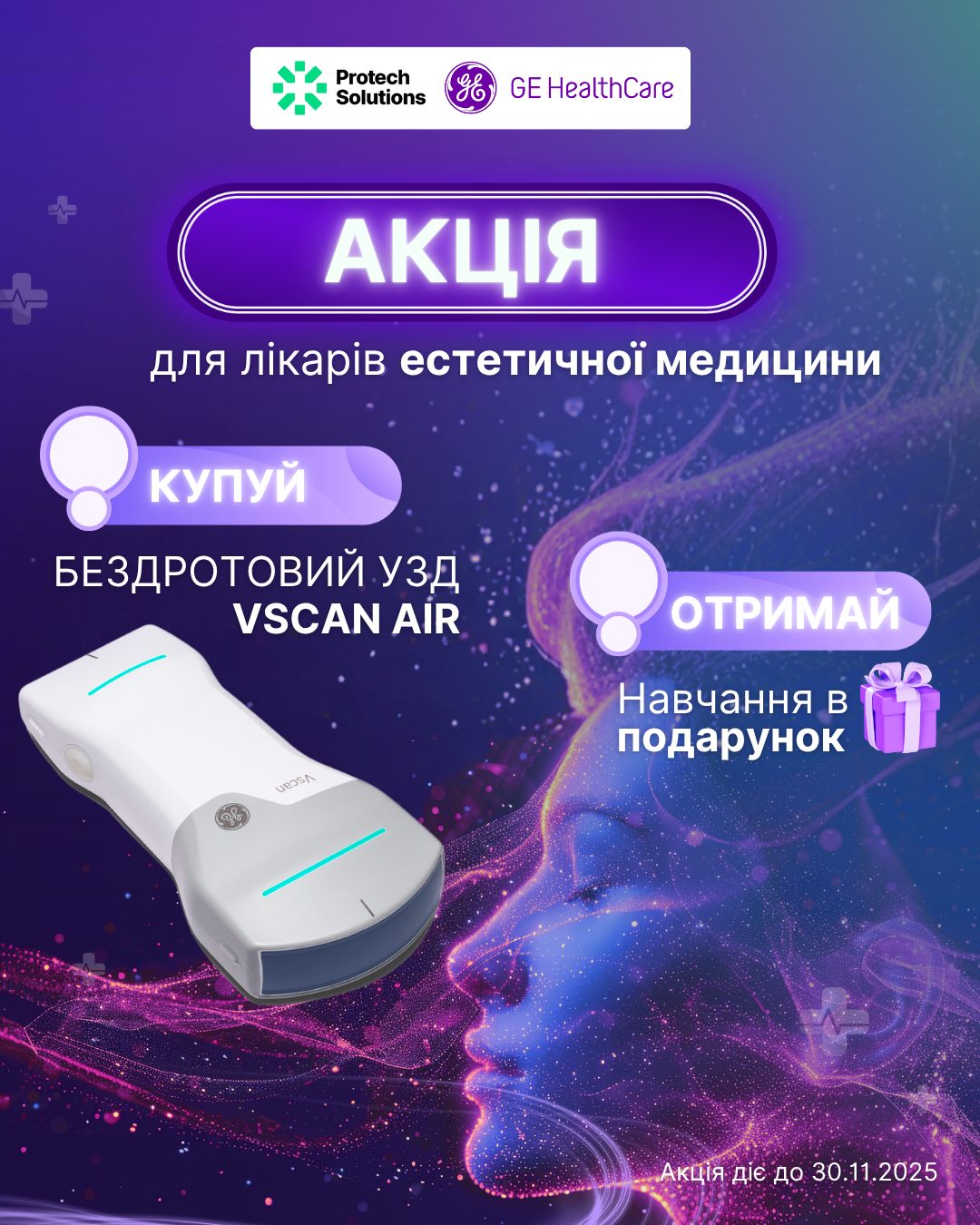 УЗД апарат Vscan + в подарунок навчальний курс*