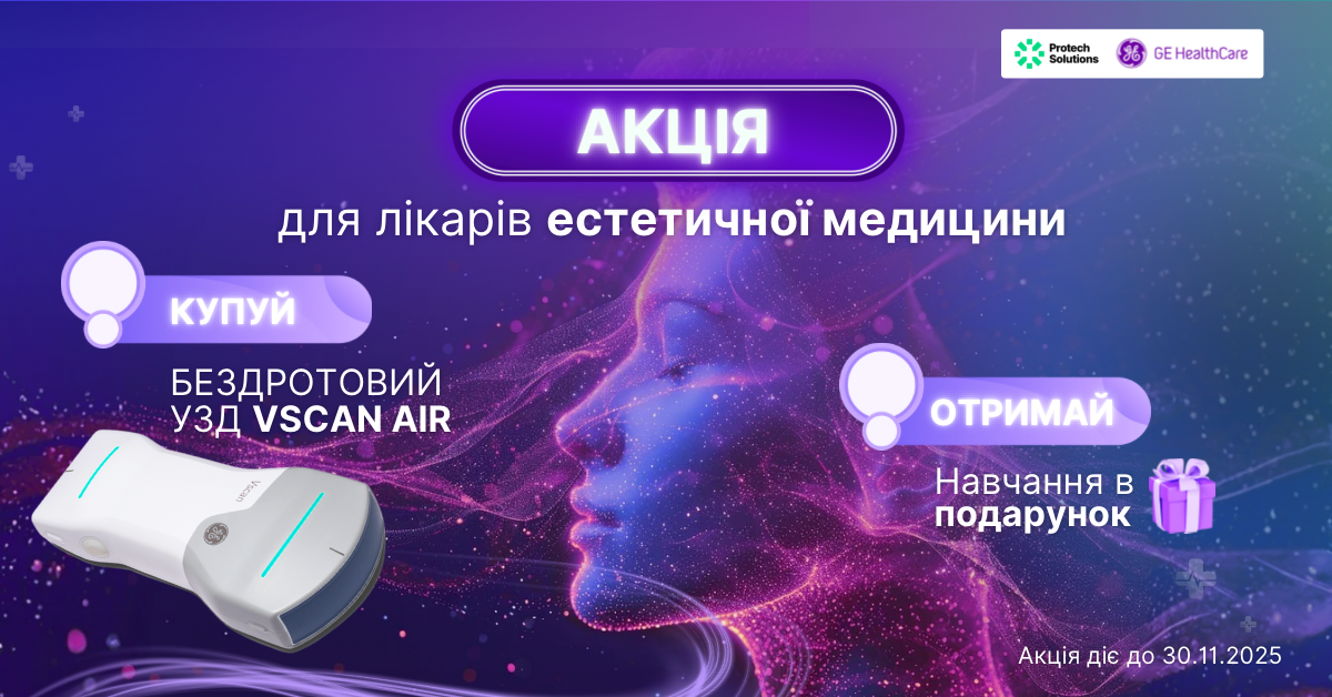 УЗД апарат Vscan + в подарунок навчальний курс*